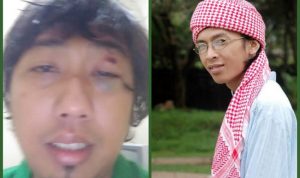 Ade Dora Jadi Korban Tsunami Banten, Aa Jimmy Dikabarkan Meninggal