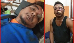 Dua Wartawan Babak Belur Dihajar Oknum TNI Denzipur 12 Nabire