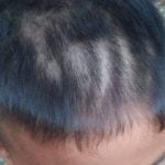 Oknum Guru Banyuwangi Cukur Rambut Murid Tak Beraturan Hingga Luka