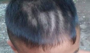 Oknum Guru Banyuwangi Cukur Rambut Murid Tak Beraturan Hingga Luka