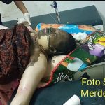 Tanpa Sebab, Seorang Wanita di Muna Membakar Dirinya Sendiri