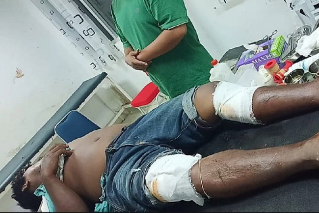 Melawan Saat Ditangkap, Pengedar Sabu Ditembak
