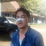 Wartawan Digebuki 10 Orang Diduga Calo di Satpas SIM Daan Mogot