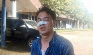 Wartawan Digebuki 10 Orang Diduga Calo di Satpas SIM Daan Mogot