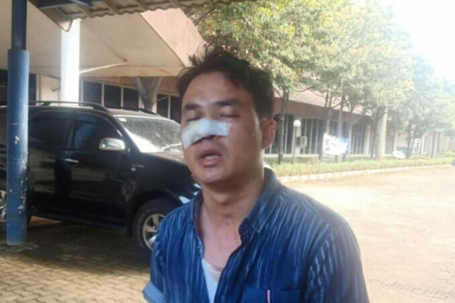 Wartawan Digebuki 10 Orang Diduga Calo di Satpas SIM Daan Mogot
