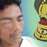 Pemuda Namrole Diduga Dipukul Oknum Polisi Hingga Matanya Bengkak