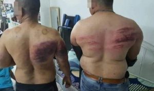 Majikan Aniaya Karyawannya Karena Berpuasa: Yang Memberimu Gaji Aku atau Tuhanmu?